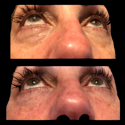 Ojeras